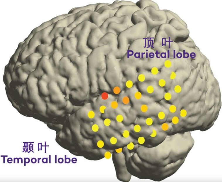 听力快讯丨失语者的福音?科学家解码大脑隐藏的语言信号-杭州听工场科技有限公司