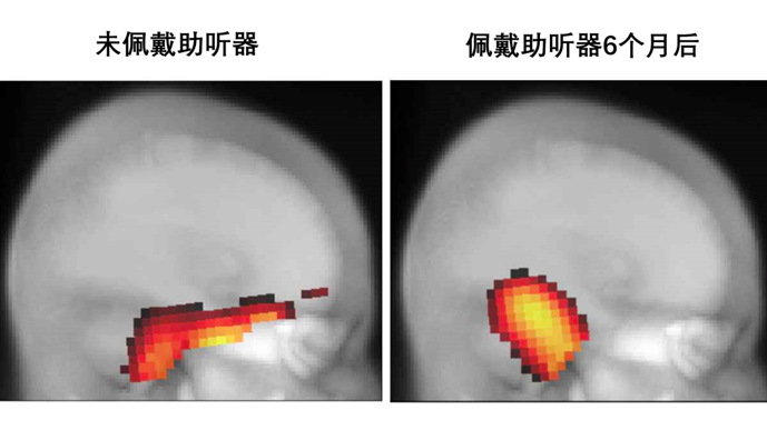 听力快讯丨听力丧失如何强化你的其他感官-杭州听工场科技有限公司