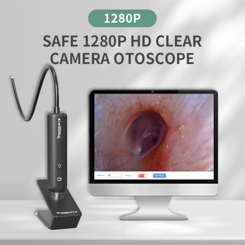 New Model Best Price High-quality Intelligent OEM Inspection Otoscope Ear Endoscope Camera 1280x720 Resolution 30FPS MJPG USB product detail