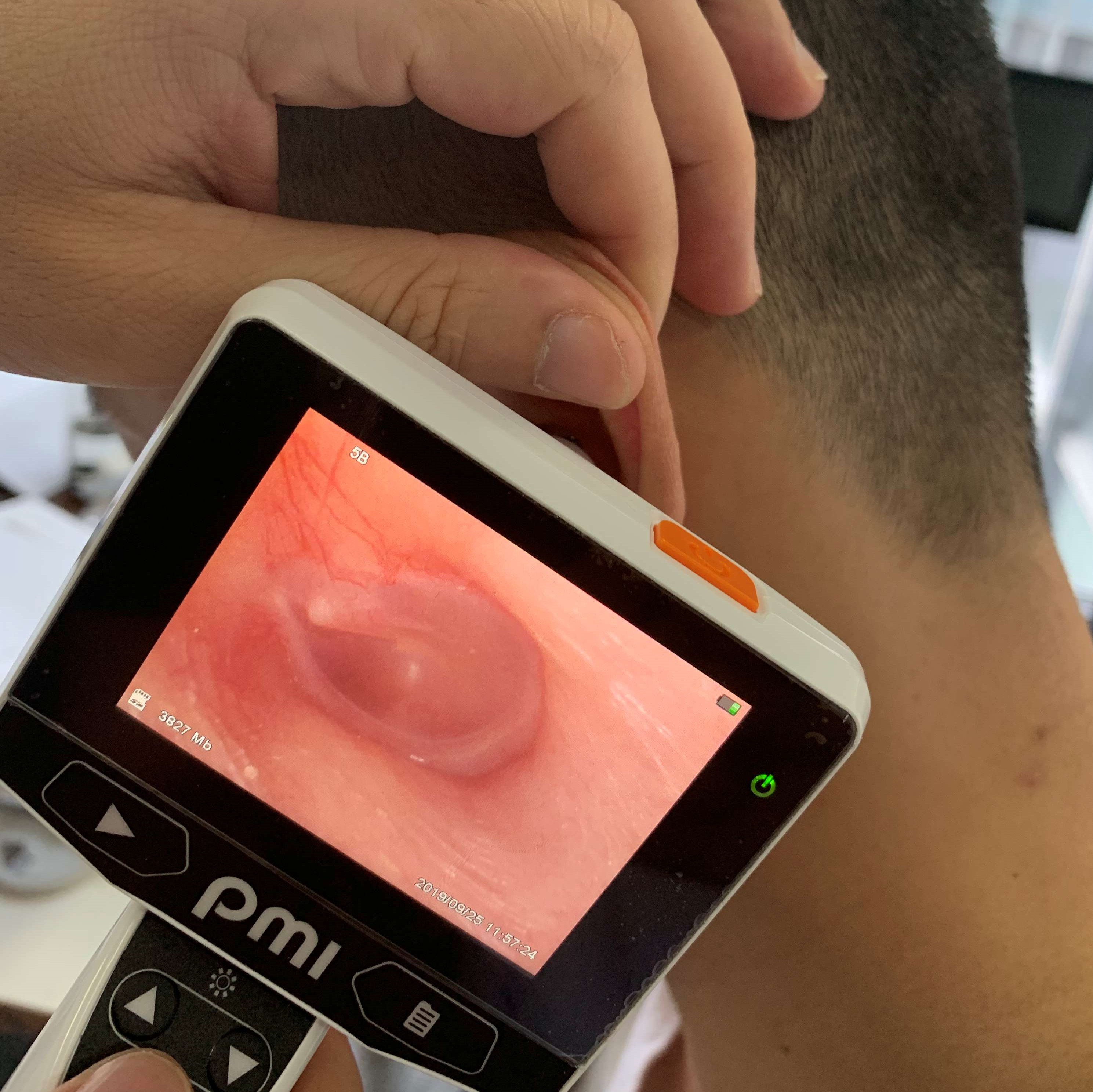 Hearing Protector Riester Digital Endoscope Otoscope HD Video USB Interface Class I Model 900 White 225g product detail