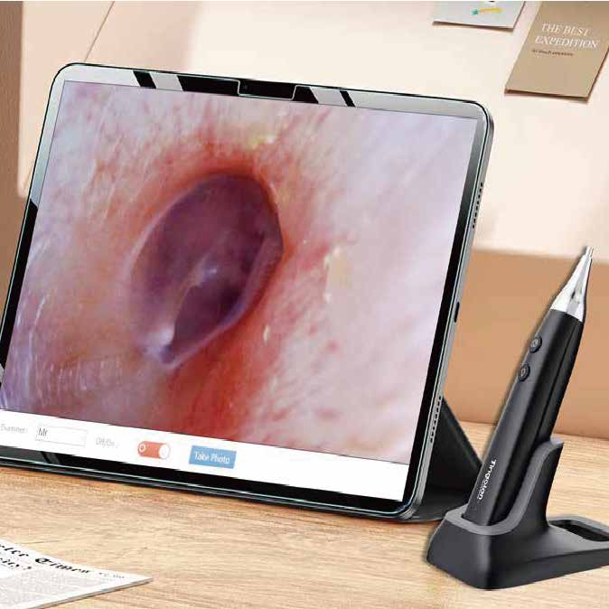 Tingoton Wholesale Veterinary Equipment Ent Visual Acuity Examination Electric Ultrasonic & Electronic Otoscope CE Certified product detail