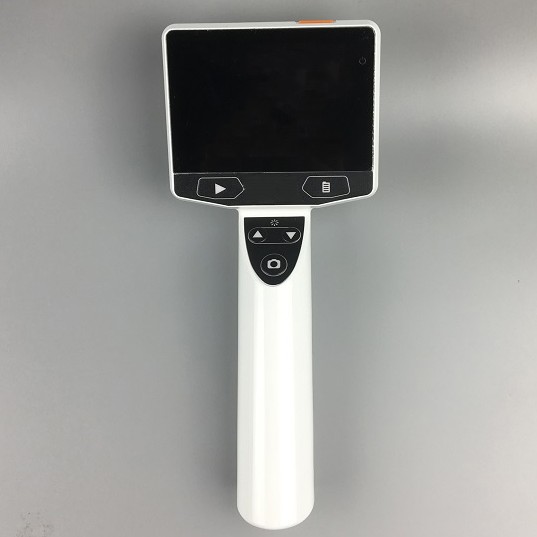 Wholesale High Quality Hearing Protector Riester HD Visual Video Otoscope Digital White USB Surgery Medical Hospital Use product detail